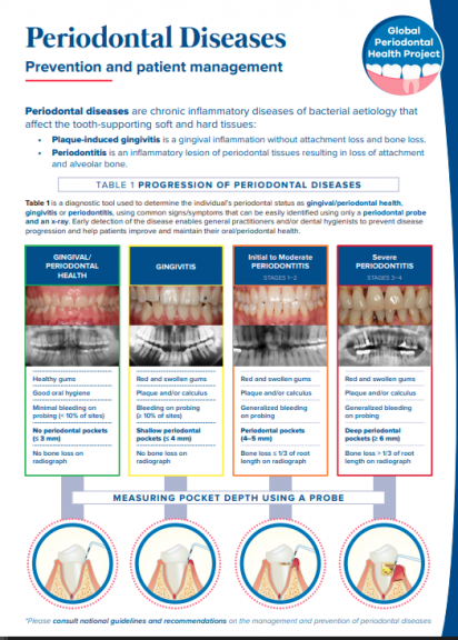 Periodontal diseases chairside guide_Prevention and patient management_chairside guide