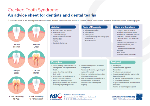cracked tooth syndrome infographic advice sheet