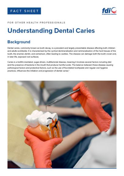 Understanding Dental Caries