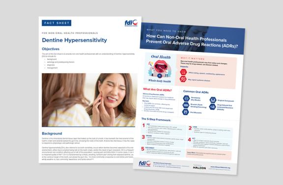 Dentine Supersensitivity Fact Sheets